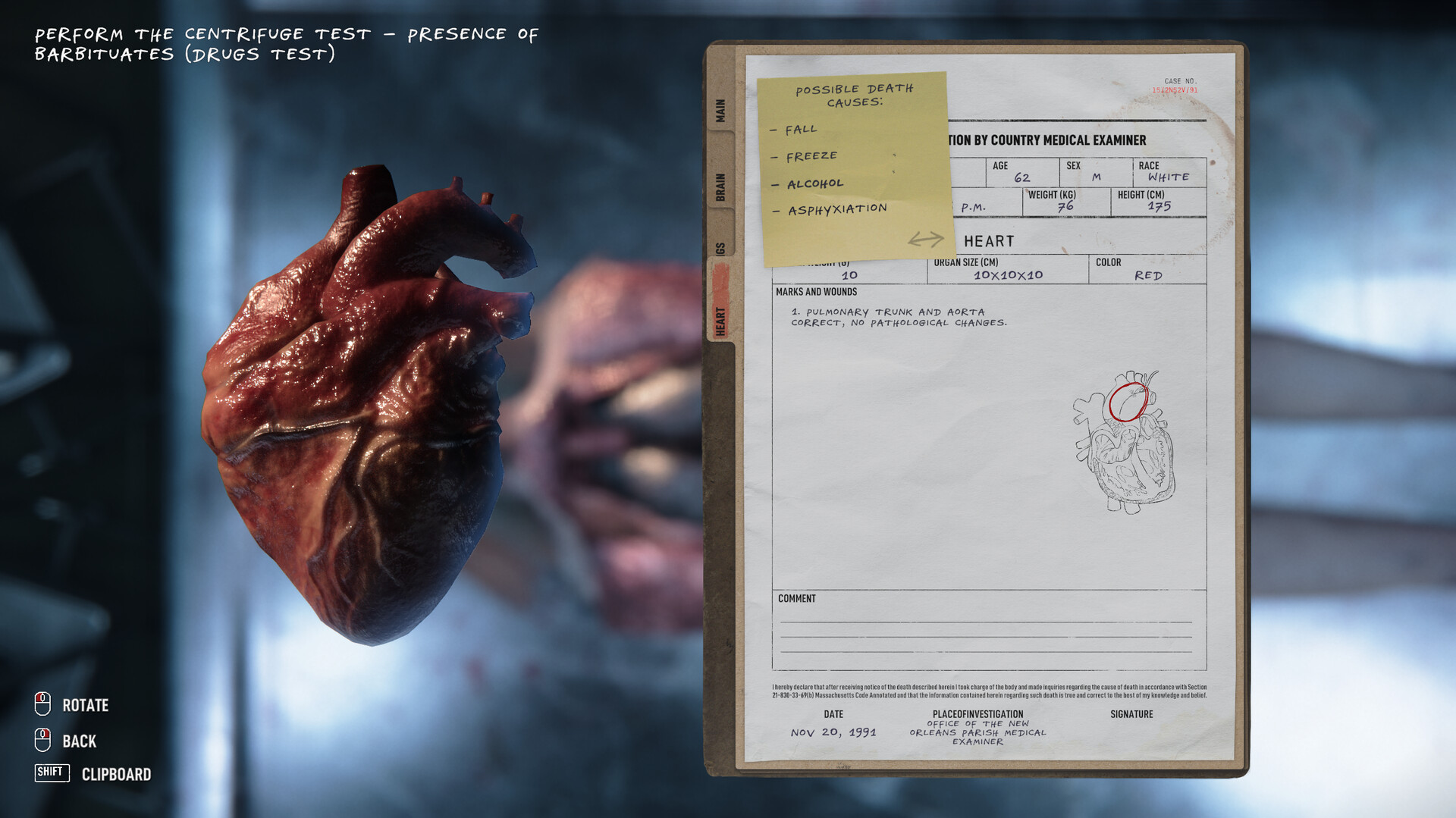 Autopsy Simulator Preview 3